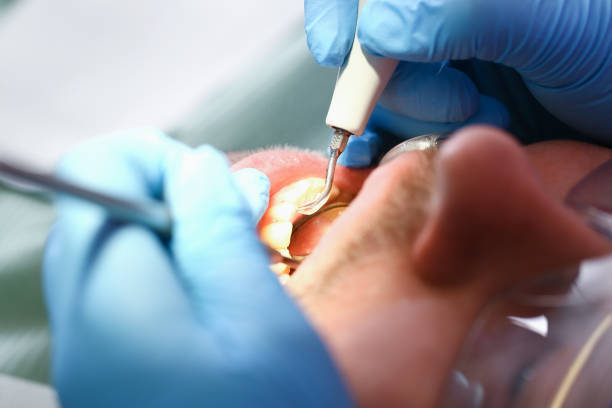 Best Emergency Treatment for Oral Infections in Wayne City, IL
