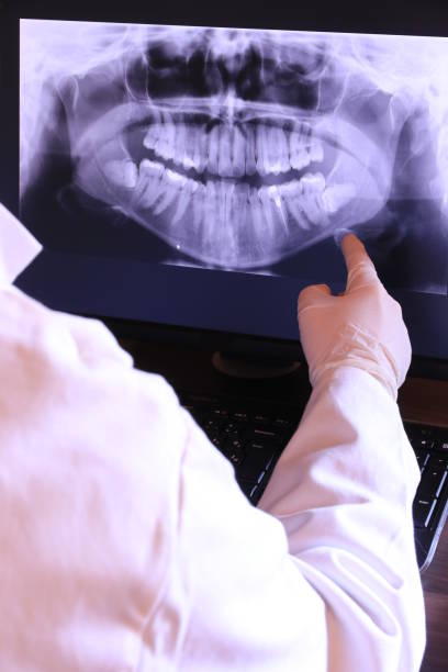Best Emergency Wisdom Tooth Extraction in Wayne City, IL